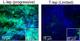 Skin biopsy sections