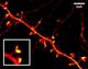 STED image of a nerve cell