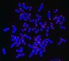RNA component of telomerase