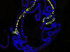 Dosage compensation in male flies: Balance between sexes