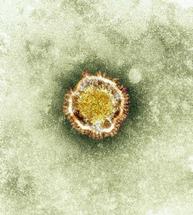 Tactics of new Middle East virus suggest treating by altering lung cells' response to infection