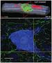 Stem cell injections improve spinal injuries in rats