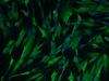 RNA offers a safer way to reprogram cells