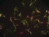 Mechanism uncovered behind Salmonella virulence and drug susceptibility